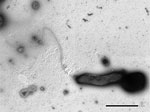 Haematospirillum jordaniae from a human blood sample. Scale bar indicates 1 μm. Source: (5). 