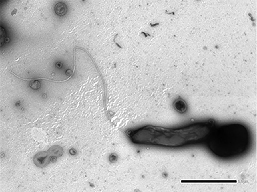 Haematospirillum jordaniae from a human blood sample. Scale bar indicates 1 μm. Source: (5). 