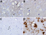 Immunohistochemical analyses of disease-associated prion protein (PrP) in the CNS of transgenic (Tg) and gene-targeted (Gt) mice infected with Finland, Norwway, and North America chronic wasting disease (CWD) isolates. A) GtQ mice (CWD-susceptible Gt mice in which the PrP coding sequence was replaced with one encoding glutamine at codon 226) infected with CWD isolate from Finland moose 1 (MF-1). B) TgE mice (Tg mice expressing cervid PrP with glutamate at residue 226) infected with M-F1. C) GtQ mice infected with CWD isolate from Norway moose 1 (M-NO1). D) GtQ mice infected with CWD isolate from US moose 1. Arrows in panels A, B, and C indicate small puncta of PrP. Immunohistochemistry sections were stained with fragment antigen binding D18. Original magnification ×10. 