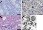 Histopathology and electron microscopy of nodules and lung tissue from a gray seal (Halichoerus grypus) with novel poxvirus, North Sea, Germany. A) Histopathology of nodules shows severe papillary epithelial hyperplasia with infiltration of neutrophils. Scale bar indicates 200 μm. B) Histopathology of ballooning degeneration of epithelial cells. Arrows indicate large eosinophilic intracytoplasmic inclusion bodies. Scale bar indicates 50 μm. C) Histopathology of the lung shows multifocal moderate pneumonia with infiltration of mononuclear cells and neutrophils with proliferation of pneumocytes type II and intra-alveolar histiocytosis, severe atelectasis, and hyperemia. Scale bar indicates 100 μm. D) Negative-contrast electron microscopy of lung tissue. Microscopy revealed poxvirus-like viral particles. Scale bar indicates 300 nm. Inset: closeup of poxvirus-like particles, which had an oval shape ≈250 nm × ≈200 nm and an irregular surface with randomly arranged tubular structures; scale bar indicates 100 nm. 