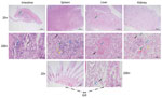 Pathologic changes in artificially bred Chinese sturgeon offspring infected with Yersinia ruckeri, China, 2022. A) Intestinal tissue showing mass intestinal villus necrosis and disordered structure; a large amount of mucosal epithelial cell necrosis and shedding (black arrow); extensive intestinal gland necrosis and connective tissue hyperplasia, with multiple lymphocyte infiltration (blue arrow); thick muscularis propria layer with small amount of connective tissue hyperplasia and small amount of lymphocyte infiltration (green arrow). B) Spleen tissue showing no obvious white pulp and unclear boundary between red pulp and white pulp; large area of red pulp congestion (black arrow); excessive lymphocyte necrosis and nuclear fragmentation (blue arrow); large number of lymphocytes with ballooning degeneration and vacuolization of the cytoplasm (green arrow); excessive infiltration of neutrophils (yellow arrows). C) Liver tissue showing diffuse balloon-like cell degeneration with vacuolization of cytoplasm (black arrow), dilation of liver sinuses, and irregular cell arrangement; multiple necrotic foci with a small amount of liver cell necrosis, nuclear lysis, and enhanced eosinophilia (blue arrow); small amount of focal infiltration of lymphocytes around the central vein (green arrow). D) Renal tissue showing diffuse watery degeneration of renal tubular epithelial cells with loose cytoplasm and light staining (black arrow) and loose arrangement of renal tubules; renal tubular epithelial cell necrosis, nuclear fragmentation (blue arrow), renal tubular structure disorder, accompanied by a small amount of lymphocyte infiltration (yellow arrow); excessive glomerular dilation with eosinophilic substances visible in the renal capsule (green arrow), cell necrosis and dissolution in the lumen, and disappearance of capillary loop structure (red arrow). E) Gill tissue showing small necrotic and detached pieces (black arrow) accompanied by a small amount of lymphocyte infiltration (blue arrow).