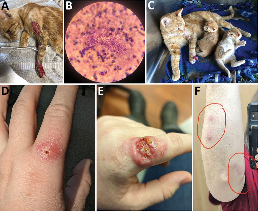 Clinical manifestations seen in pregnant 2-year-old cat and human from a sporotrichosis cluster in domestic cats and veterinary technician, Kansas, USA, 2022. A) Severe lesion on cat 1 in August 2022; B) cytological examination from cat 1’s lesions showing numerous cigar-shaped yeasts consistent with Sporothrix; C) image of cat 1 with kittens and improved lesion in September 2022; D) lesion on the finger of a veterinary technician who had contact with cat 1; E) ulcerated and more severe lesion on technician’s finger after X days; F) lymphadenopathy on technician’s arm. Cat 1 initially was treated with antibiotics in August 2022 and lesions improved on antifungal therapy. However, the cat’s lesions returned and worsened in October 2022, after discharge from the facility. In November 2022, a veterinary technician developed a small lesion 1 week after being poked through the glove by a claw on cat 1’s infected paw. Lymphadenopathy progressed up the technician’s arm (red circles, panel F) in a sporotrichoid pattern along dermal and lymphatic vessels.