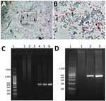 Enterocytozoon bieneusi detection in fecal sample and liver aspiration biopsy sample from a child with hematopoietic stem cell transplant, Argentina. A) Light microscopy of fecal samples after Weber’s modified trichome staining showing ovoid shaped-spores with a pinkish-red stained wall (arrows). Original magnification × 1,000; scale bars = 5 µm. B) Closer view of boxed area in panel A, showing spores (arrows). C) Agarose gel electrophoresis (2%) showing amplification products (≈390 pb) from nested PCR with inner primers EBITS1 and EBITS2 from patient fecal sample. Lane L, molecular weight ladder; lane 1, negative control (water); lanes 2 and 3, fecal samples from healthy donors; lane 4, positive feces control for E. bieneusi; lanes 5 and 6, fecal samples from patient. D) Nested PCR products from liver aspiration biopsy sample. Lane L, molecular weight ladder; lane 1, fecal sample from healthy donor; lane 2, fecal sample from patient; lane 3, liver aspiration biopsy sample from patient.