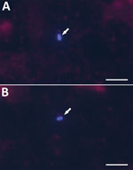 Microscopic examination Encephalitozoon cuniculi­–positive cerebrospinal fluid from immunocompetent patients, Czech Republic. Microsporidial spores (arrows) were stained with Calcofluor M2R and viewed in 490 nm. A) Patient no. 139; B) patient no. 185. Scale bar indicates 10 µm.