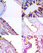 Detection of α-2,3 and α-2,6 receptors in tissues from the respiratory system of coatis (Nasua nasua), Brazil. A–C) Arrows indicate labeling of the α-2,3 receptor in the ciliated epithelium for the lectin Maackia amurensis II of the nasal concha (A), lung (bronchiole) tissue (B), and trachea (C). Scale bars = 100 µm in panel A, 50 µm in panel B, and 20 µm in panel C. D–F) Arrows indicate labeling of the α-2,6 receptor in the endothelium for Sambucus nigra lectin in the arteriole (D), rostral concha (E), and lung (bronchiole) (F). Scale bars = 20 µm in panels D and E, 50 µm in panel F. Tissue was counterstained with hematoxylin and revealed with diaminobenzidine chromogen.