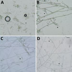 Lactophenol cotton blue mount of a culture from a brain biopsy sample from a 3-year-old patient in India with Fonsecaea monophora infection, showing dematiaceous septate hyphae with different types of conidiation (arrowheads). A) Multicelled sessile conidial chains resembling genus Cladophialophora, leading to the initial misidentification. B) Fonsecaea-type conidiation. C) Rhinocladiella-type conidiation. D) Asterisks of Fonsecaea-type conidiation.