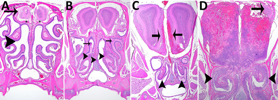 Hematoxylin and eosin staining of head sections of C57BL/6 mice exposed to aerosolized Burkholderia pseudomallei strain ATS2021, the causative strain in an outbreak of 4 cases, 2 of them fatal, in the United States in 2021. Shown are the nasal cavity (including nasal turbinates, nasal septum, respiratory and olfactory epithelium, lamina propria with supporting tissues and glands, nerve bundles, and nasal air passages); cribriform plate (bone and olfactory/trigeminal nerves); and cranial vault with olfactory bulb. A) Day 1 after exposure, dose 107 CFU, showing nasal turbinates (arrowhead), cribriform plate (asterisks), and olfactory bulb (arrow) that are essentially normal. Original magnification ×2. B) Day 2 after exposure, dose 4,490 CFU, showing mild necrosuppurative rhinitis (arrowheads) with edema, cellular debris and suppurative inflammation in few nasal air passages (arrows). Original magnification ×2. C) Day 3 after exposure, dose 4,490 CFU, showing multifocal moderate necrosuppurative rhinitis (arrowheads) and necrotizing and hemorrhagic meningoencephalitis of the olfactory bulb (arrows). Original magnification 2. D) Day 4 after exposure, dose 1,150 CFU. There is diffuse necrosuppurative rhinitis of the nasal turbinates (arrowheads), showing extensive necrosis and hemorrhage of the olfactory bulb with a small portion of recognizable neural tissue evident (arrow). Original magnification ×2.