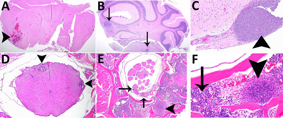 Histopathologic analyses of the neurologic system of C57BL/6 mice after inhalation of Burkholderia pseudomallei strain ATS2021, the causative strain in an outbreak of 4 cases, 2 of them fatal, in the United States in 2021. A) Day 5 after exposure, dose 1,150 CFU. Cerebrum showing focally extensive necrotizing and hemorrhagic meningoencephalitis (arrowhead). Hematoxylin and eosin (HE) stain; original magnification ×2. B) Day 9 after exposure, dose 107 CFU. Pons and cerebellum. There is multifocal necrotizing meningoencephalitis (arrows). HE stain; original magnification ×2. C) Day 10 after exposure, dose 1,150 CFU. Cerebrum with olfactory peduncle filled with viable and degenerate neutrophils with no recognizable peduncular tissue (arrowhead). HE stain; original magnification ×20. D) Day 9 after exposure, 107 CFU. Spinal cord, thoracic, shows multifocal meningomyelitis (arrowheads). HE stain; original magnification ×4. E) Day 5 after exposure, 1,150 CFU. Spinal cord and vertebrae, lumbar at cauda equina, show is multifocal suppurative perineuritis of spinal nerves (arrows). Note the necrotizing lesion within the vertebral bone marrow (arrowhead) HE stain; original magnification ×10. F) Day 4 after exposure, dose 1,150 CFU. Spinal cord and vertebra, thoracic, show necrotizing osteomyelitis (arrowhead). Note the loss of distinction of bone marrow cells compared to normal cells of the bone marrow (arrow). HE stain; original magnification ×40.