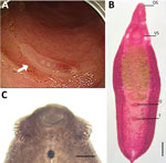 Analysis of a worm identified as Echinostoma cinetorchis removed during colonoscopy from a 69-year-old woman in South Korea. A) Colonoscopy image showing a moving trematode in the mucosa of the descending colon. B) Whole body of the worm. Scale bar = 0.6 mm. C) Head part of the worm showing collar spines (37 in total number) on the head collar around the oral sucker, by which it could be morphologically identified as a 37-collar-spined echinostome. Scale bar = 0.1 mm). O, ovary; OS, oral sucker; T, testis; VS, ventral sucker.