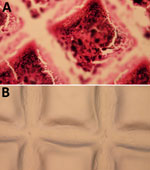 Gram-stained platelet bag coupons incubated with Staphylococcus saprophyticus in APH PLT before sonication and Gram-stained duplicate coupons after sonication. A) Accumulation of platelets and gram-positive cocci on the coupon. B) Visual analysis after sonication showing no evidence of platelets or cocci on the surface of the coupon, indicating that the sonication procedure effectively removed the biofilm and bacteria. The grid pattern observed on the coupon reflects the texture of the inner surface of Amicus (Fresenius Kabi, https://www.fresenius-kabi.com) platelet bags. APH PLT, apheresis platelets.