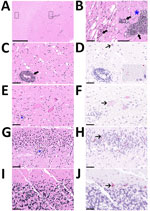 Histology of brain and spinal cord used to detect rustrela virus (RusV) in wild mountain lion (Puma concolor) with staggering disease, Colorado, USA. RusV RNA was detected by RNAscope Reagent Kit-Red (Advanced Cell Diagnostics/bio-techne, https://www.bio-techne.com) in situ hybridization. All sections demonstrate artifactual clefting of the neuropil due to freezing of the tissue postmortem. A) Cerebral cortex with perivascular cuffing and mild gliosis of the white and gray matter; boxes indicate detailed areas in panel B. Scale bar indicates 2.5 mm. B) The white matter (left panel) is minimally affected by perivascular lymphohistiocytic infiltrates (bold arrow), compared with the gray matter (right panel), also showing gliosis (asterisk). Scale bar indicates 100 µm. C) Midbrain affected by perivascular cuffing. Scale bar indicates 50 µm. D) Midbrain showing chromogenic labeling (fast red) of RusV in neuronal cell bodies (slender arrow) and in the neuropil (inlay). Scale bar indicates 50 µm. E) Spinal cord with 3 motor neurons showing variable degree of degeneration/necrosis and also gliosis (asterisk). Scale bar indicates 50 µm. F) Spinal cord with affected motor neurons with RusV RNA detection. Scale bar indicates 50 µm. G) Hippocampus exhibiting irregular architecture of the granule layer and gliosis (asterisk). Scale bar indicates 50 µm. H) Hippocampus with numerous RusV RNA signals in neurons of the granule cell layer in areas with or without irregular architecture. Scale bar indicates 50 µm. I) Cerebellum, no indication for inflammation or any degenerative process. Scale bar indicates 50 µm. J) Cerebellum with abundant RusV RNA labeling in Purkinje cells. Scale bar indicates 50 µm. A–C, E, G, I) Hematoxylin-eosin staining; D, F, H, I) RNAscope in situ hybridization with probes against the nonstructural protein–coding region of RusV, counterstained with Mayer’s hematoxylin.