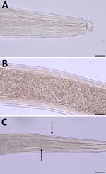 Morphologic features of adult female Thelazia callipaeda eyeworm isolated from an American black bear in Coolbaugh Township, Monroe County, Pennsylvania, USA, 2023. A) Anterior end showing the large, deep, cup‐shaped buccal cavity. Scale bar indicates 50 μm. B) Midbody region showing the thin transverse cuticular striations pattern and numerous coiled first-stage larvae. Scale bar indicates 100 μm. C) Anterior end showing the location of the vulvar opening anterior to the esophageal-intestinal junction. Dashed black arrow indicates esophageal-intestinal junction; solid black arrow indicates the vulval opening. Scale bar indicates 100 μm.