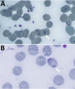 Giemsa-stained thin blood film from a case of autochthonous human Babesia divergens infection, England. A) Stains show characteristic Maltese cross form (arrow) and erythrocytes containing 5 pyriform rings. Original magnification ×1,000. B) Absence of pigment in erythrocytes (arrow). Original magnification ×1,000