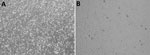 Cytopathic effect associated with Oropouche virus infection in a 42-year-old man from Italy who visited Cuba during July 19–29, 2024, observed by using light microscopy on Vero E6 cells monolayer after 5 days of incubation. A) Semen sample from patient (Appendix). B) Semen sample from uninfected control. Original magnification ×10.