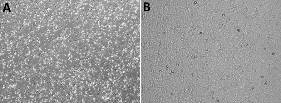 Cytopathic effect associated with Oropouche virus infection in a 42-year-old man from Italy who visited Cuba during July 19–29, 2024, observed by using light microscopy on Vero E6 cells monolayer after 5 days of incubation. A) Semen sample from patient (Appendix). B) Semen sample from uninfected control. Original magnification ×10.