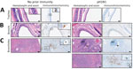 Hematoxylin and eosin–stained and immunohistochemistry tissue samples from a study of influenza A(H5N1) immune response among ferrets with pH1N1 immunity. A) Tracheal tissue. Scale bars indicate 20 mm; inset shows magnification ×400. B) Bronchial tissue. Scale bars indicate 50 mm; inset shows magnification ×200. C) Bronchiole tissue. Scale bars indicate 50 mm; inset shows magnification ×200. Ferrets with no prior immunity (left panels) or existing influenza A(H1N1)pdm09 immunity (right panels) were infected with 104 50% tissue culture infectious dose of H5N1 strain A/dairy cattle/Texas/24-008749-001/2024(H5N1) and humanely euthanized 3 days postinfection. Images show hematoxylin and eosin stained (purple) tissues and immunohistochemistry of influenza A nucleoprotein (blue). Dotted squares indicate areas that are magnified within the inset panel in tissues from ferrets with no prior immunity versus pH1N1-immune ferrets. BALT, bronchus-associated lymphoid tissue; Br, bronchiole; pH1N1, influenza A(H1N1)pdm09.