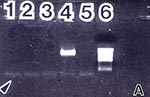 Thumbnail of Amplification results of normal and PKD kidney tissue and cyst fluids with universal fungal primers ITS 1 and NL 4. 2A: DNA from healthy human kidney tissue diluted 1:10, 1:100 and 1:1,000 (lanes 1-3); control fungal DNA, A. tamarii (lane 4); negative control (lane 5); 1 kb ladder (lane 6); arrow indicates migration front. 2B (NL 4) and 2C (ITS 1): two cyst fluids, donor 6, negative for detectable endotoxin and ß-DG (lanes 1 and 5); two cyst fluids, donor 4, positive for ß-DG (lanes