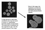 Thumbnail of Proposed means of infection by C. neoformans.