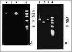 Thumbnail of Polymerase chain reaction (PCR) products. A. With primers for the NadA gene. Lane 1: Patient's sample with an approximately 1.02-kb product; Lane 2: Negative control; Lane 3: Positive control. Ehrlichia chaffeensis (Arkansas strain)–infected DH82 cells; Lane 4: Molecular size markers: fX174 phage DNA cleaved with HaeIII. B. With nested primers for the 120 kDa protein gene. Lane 1: Patient's sample with an approximately 1.1-kb product; Lane 2: Positive control. E. chaffeensis (Sapulp