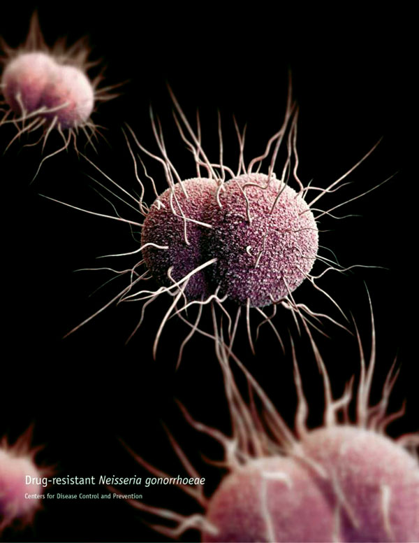 A 3-dimensional computer-generated image of drug-resistant Neisseria gonorrhoeae diplococcal bacteria. Source: Public Health Image Library.