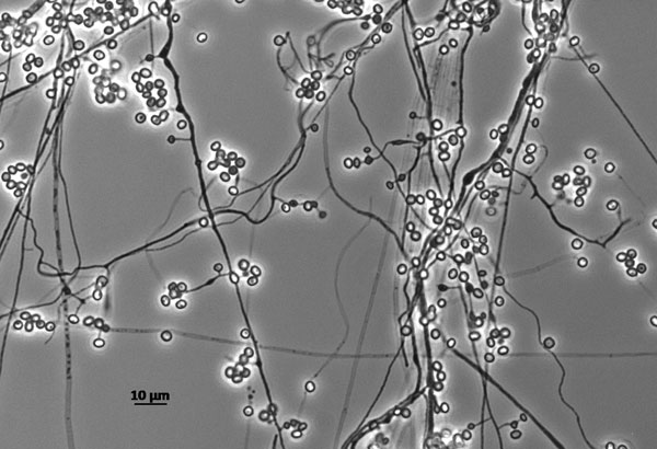 Isolate UAMH 125 Emmonsia parva grown in slide culture preparation for 14 days at 25°C. Image courtesy of Lynne Sigler, University of Alberta Microfungus Collection (now UAMH Centre for Global Microfungal Biodiversity, https://www.uamh.ca), University of Alberta, Edmonton, Alberta, Canada.